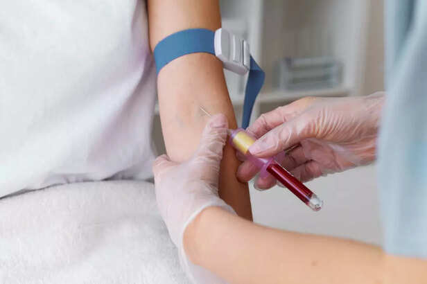 blood transfusion