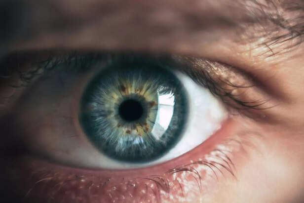 Image Div