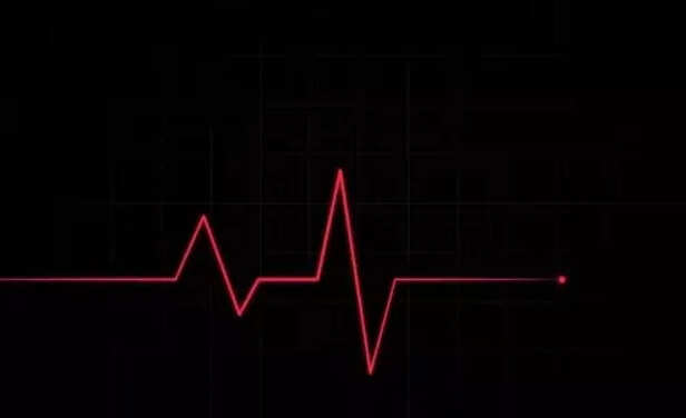 Irregular Heartbeat