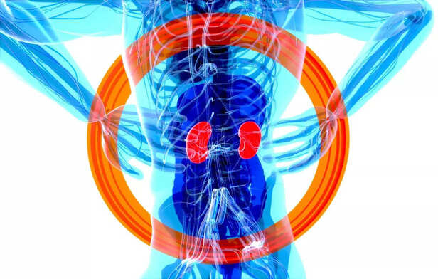 Kidney
