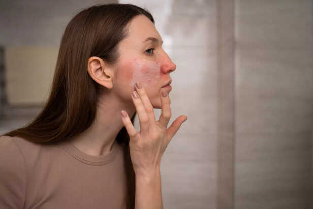 Face scars