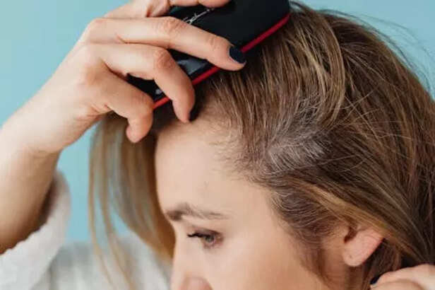 itchy scalp due to chemic
