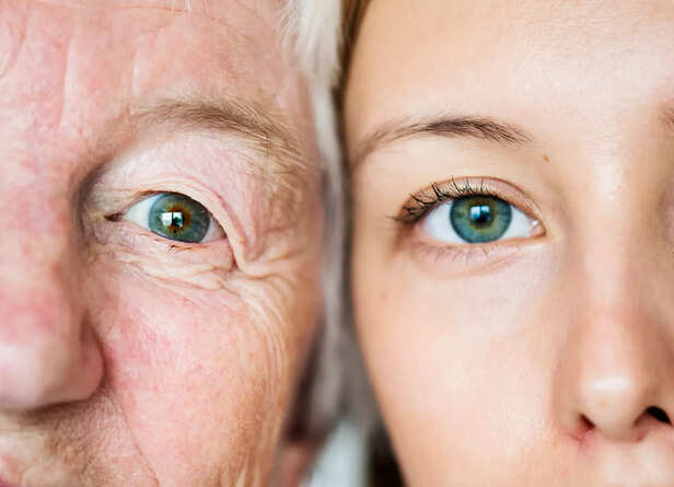 Graceful ageing