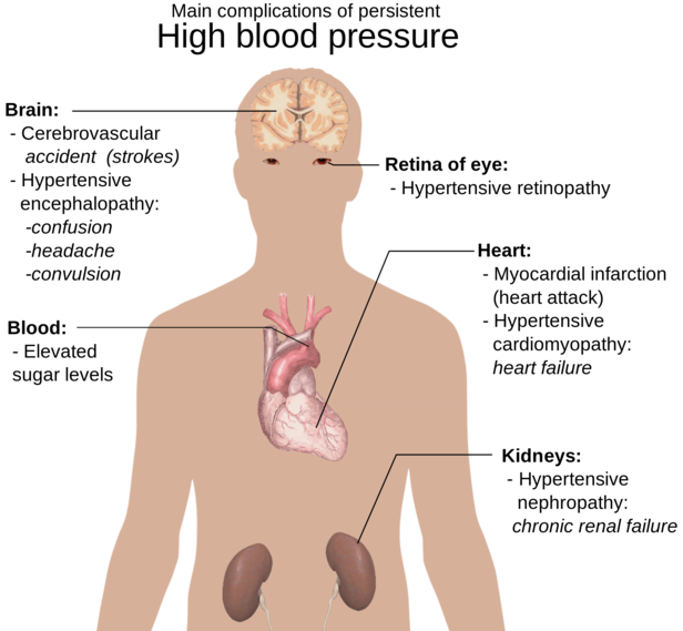 How hypertension impacts 